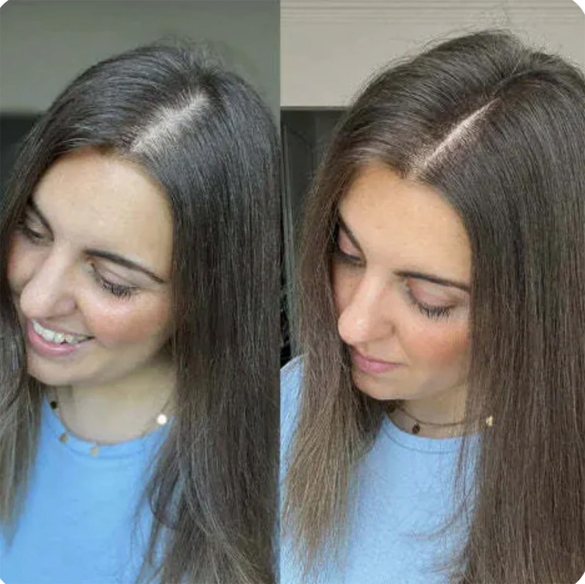 ELECTRIC SCALP MASSAGER